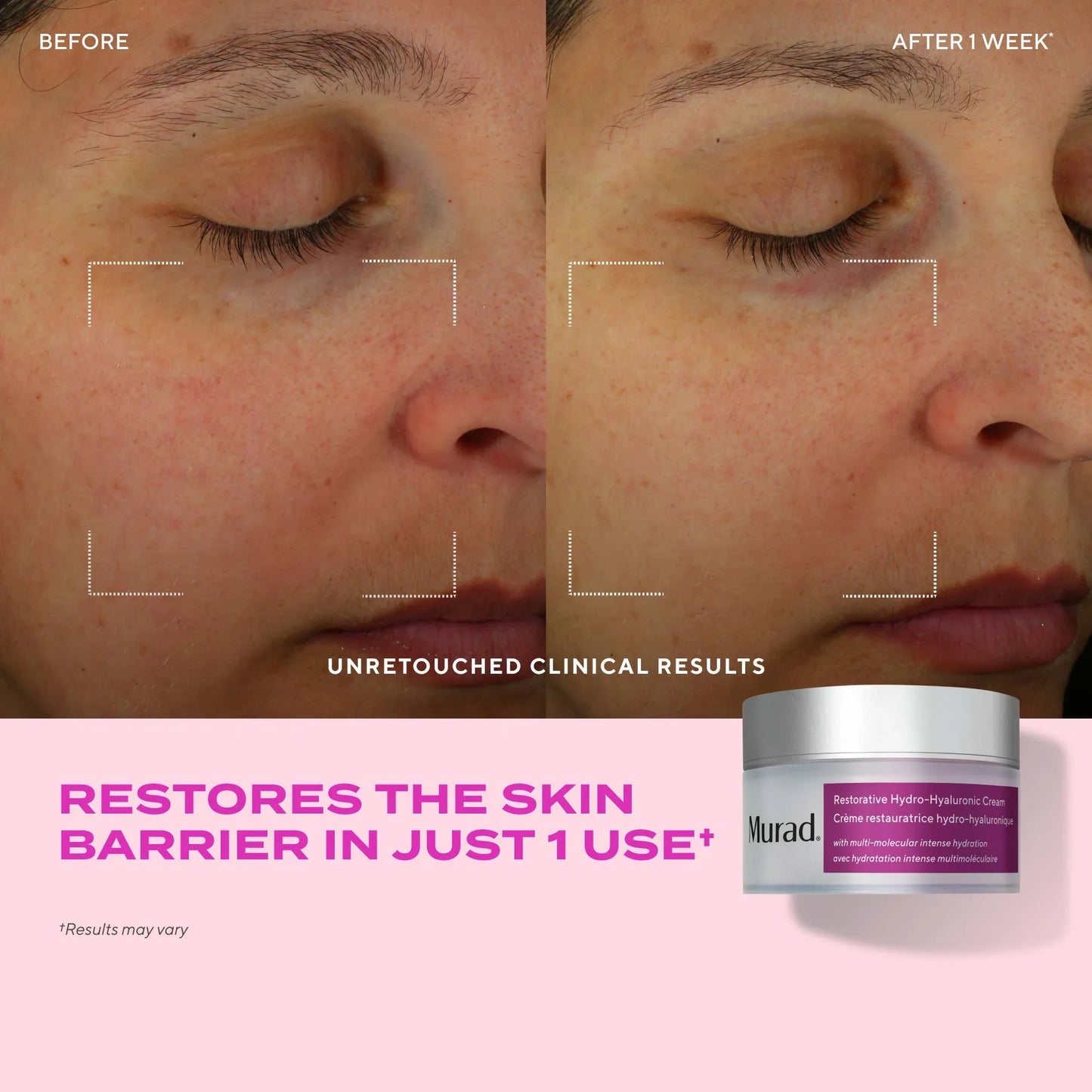 Restorative Hydro-Hyaluronic Cream