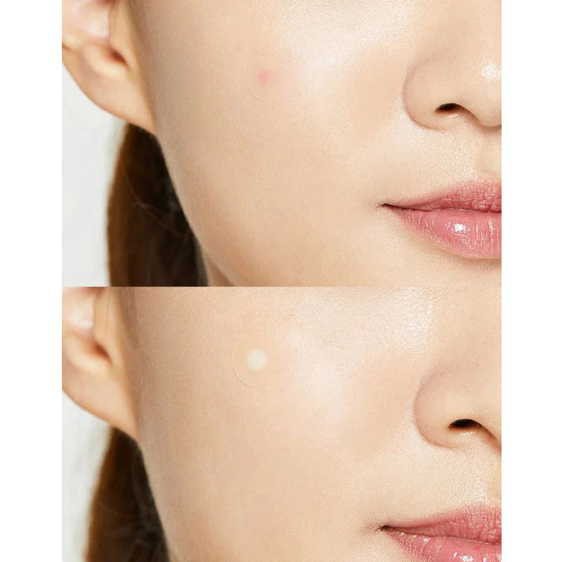Cosrx Acne Pimple Master Patch