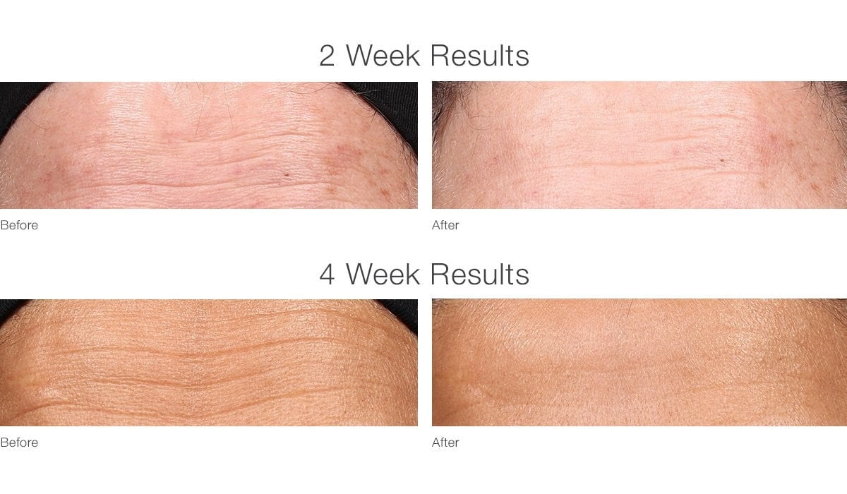 Retinol Youth Renewal Serum