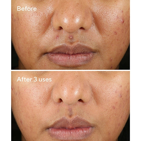 Rapid Relief Sulfur Mask (74ml)
