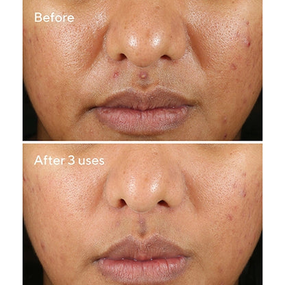 Rapid Relief Sulfur Mask (74ml)