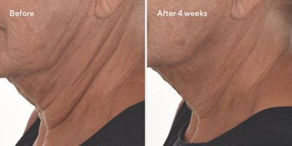 Retinal ReSculpt™ Overnight Treatment (30ml)