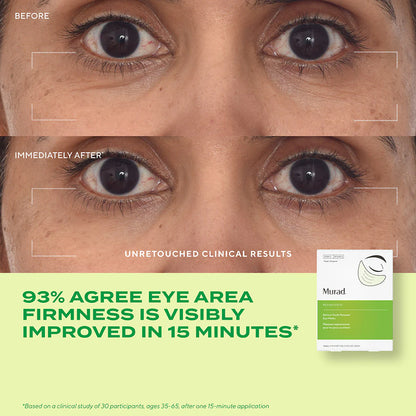 Dr. Zion x Murad Retinol Youth Renewal Eye Masks (5 pack)