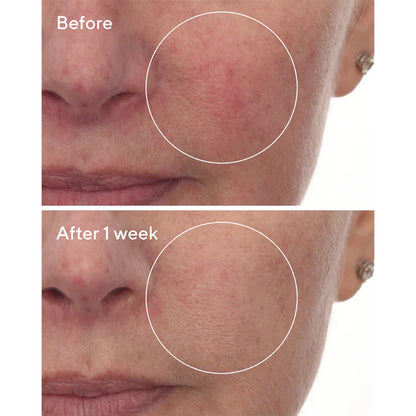 Cellular Hydration Repair Serum Refill