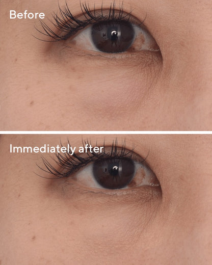 Targeted Eye Depuffer (15ml)