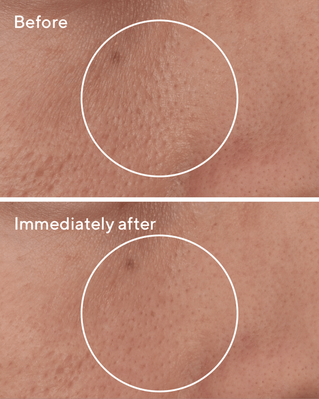 Targeted Pore Corrector (15ml)