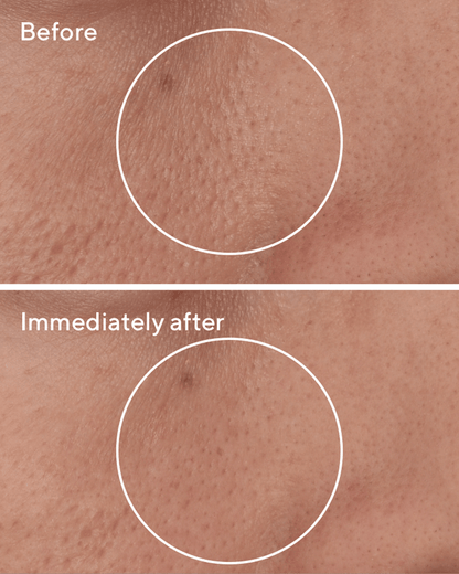 Targeted Pore Corrector (15ml)