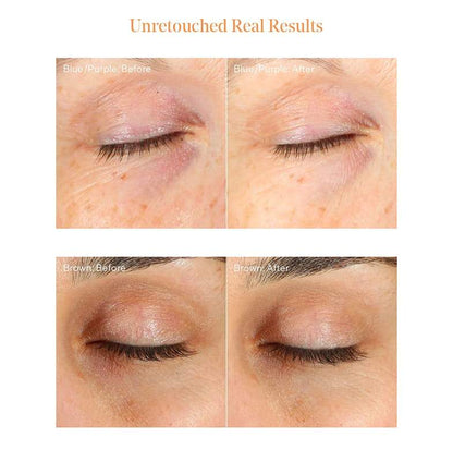 Vita-C Eyes Dark Circle Corrector (15ml)
